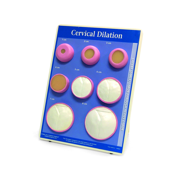 Cervical Dilatation Model